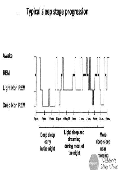 Typical sleep stage progression
